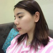 上海長征醫(yī)院整形科面部吸脂怎么樣？術后瘦臉果跟美顏相機說再見！