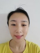 一覽北京潤美玉之光自體脂肪全臉填充案例！醫(yī)生審美很在線