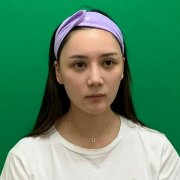 成都華美紫馨是熱瑪吉授權(quán)醫(yī)院嗎？資質(zhì)證書、案例果圖及價(jià)格全網(wǎng)對比