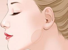 整容在下頜角危險嗎?磨下頜角有什么禁忌?