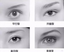 整雙眼皮有什么好處?雙眼皮手術(shù)需要注意什么?
