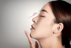 為什么自體軟骨是較好的隆鼻材料?