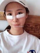 解放軍總醫(yī)院301醫(yī)院擅長(zhǎng)什么？眼整形價(jià)格表_去眼袋案例全新上線！