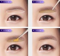 切眉術(shù)的方式有哪些?切眉術(shù)有什么優(yōu)勢?