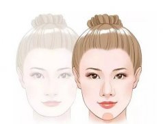 玻尿酸填充下巴恢復(fù)自然需要多久?玻尿酸填充下巴有什么優(yōu)點(diǎn)?