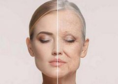 2021去皺價格表分享！去皺方法匯集，看哪個較適合你?