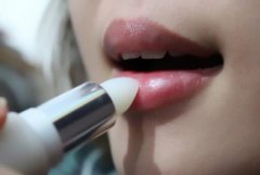 唇紅緣必須矯正的種類有哪些?