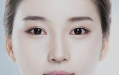 什么樣的眼睛需要開眼角?