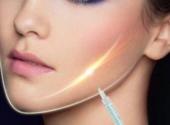 如何讓咬肌變小?注射注射瘦臉有嗎?