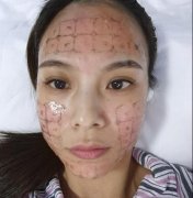 綿陽(yáng)茗匯整形醫(yī)院熱瑪吉是正規(guī)授權(quán)嗎？做的案例和價(jià)格表供查詢