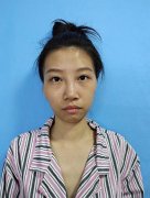 蘇州吳中維多利亞做拉皮收費多少？案例恢復(fù)記錄和價格均價反饋