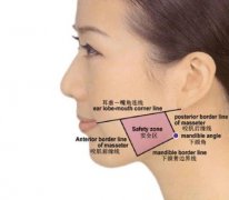 瘦咬肌一針多少錢呢?瘦咬肌價格多少?