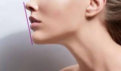 打透明質(zhì)酸豐下巴多久變軟?打透明質(zhì)酸豐下巴注意事項(xiàng)有哪些?