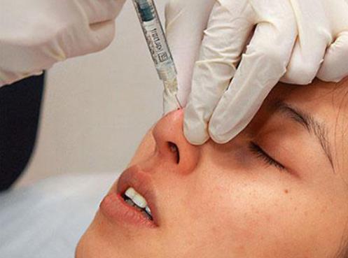 注射隆鼻能持續(xù)多久?注射隆鼻前需要注意什么?