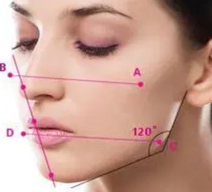 什么的下頜角是每個人都喜歡的下頜角?下頜角手術(shù)恢復(fù)期有多長?