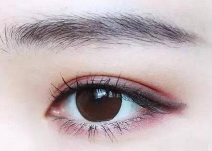 雙眼皮手術(shù)整容后恢復(fù)快嗎?