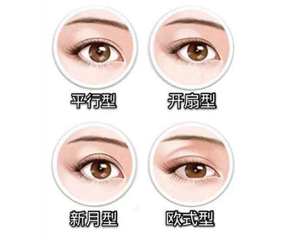 免麻微創(chuàng)雙眼皮經(jīng)久不衰嗎?微創(chuàng)雙眼皮怎么樣?