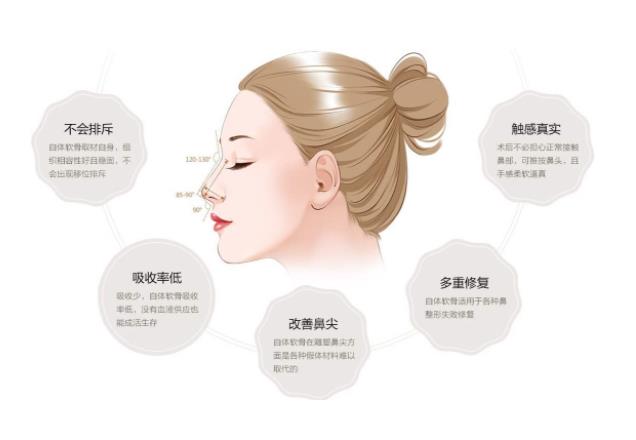 自體軟骨隆鼻的費用是多少?自體軟骨隆鼻有哪些種類?