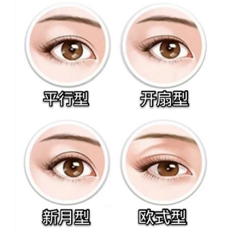 切開雙眼皮是長期的嗎?埋線好還是切開雙眼皮比較好?