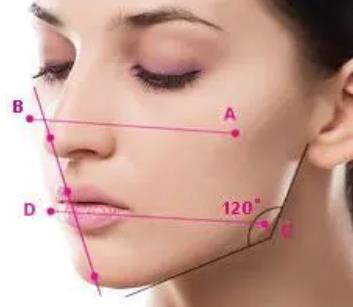 什么的下頜角是每個人都喜歡的下頜角?下頜角手術(shù)恢復(fù)期有多長?