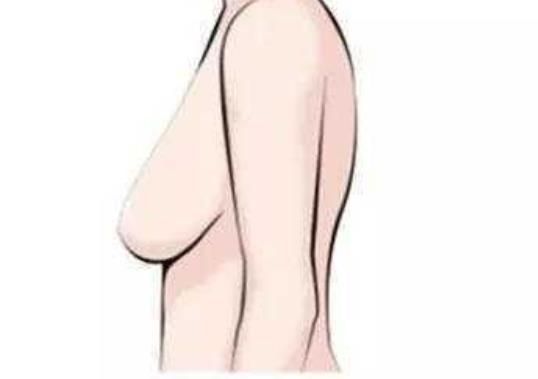 胸下垂矯正手術(shù)好多錢？會(huì)不會(huì)影響哺乳？你關(guān)心的問(wèn)題都整理了哦！