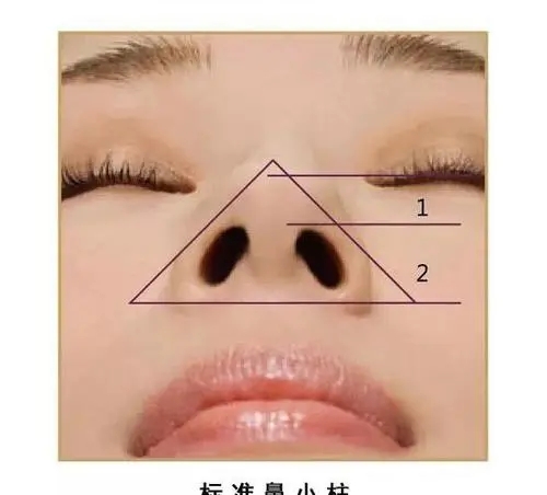 鼻小柱的理想形狀是什么?如何判斷自己是否有鼻小柱缺損?