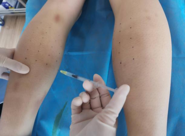 注射瘦腿到底有用嗎？哪些人不適合打注射瘦腿呢?注射瘦腿適用范圍盤點(diǎn)