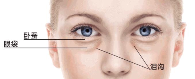 有了淚溝怎么辦？課代表來了！給你3種方法，讓你輕松擺平它!