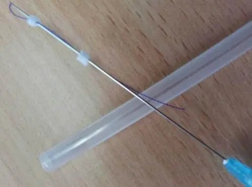 埋線提升蛋白線有沒有用？埋線提升蛋白線術(shù)后的注意事項(xiàng)有哪些?