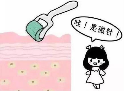 想做整形必看——什么是微針?微針有什么功