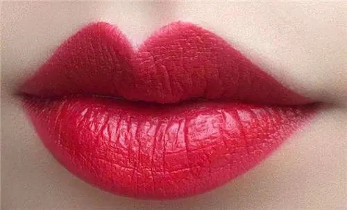 唇缺損修復(fù)整形手術(shù)中的注意事項(xiàng)有哪些?