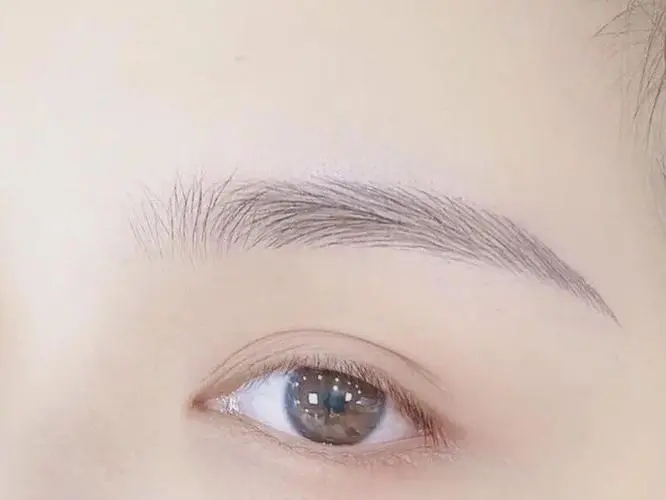 什么是眉弓隆高術(shù)?眉弓隆高主要適應(yīng)人群有哪些?