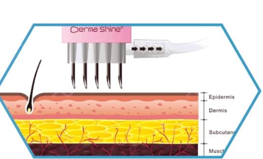 答疑解惑 | 水光補(bǔ)水打一次的價(jià)格是多少?