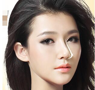 鼻尖大、鼻尖下垂怎么辦?鼻子整形方法匯總