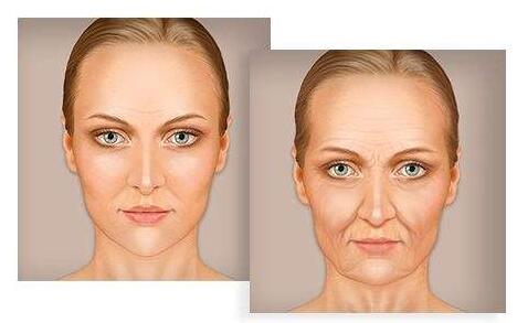 填充法令紋的副作用和風險