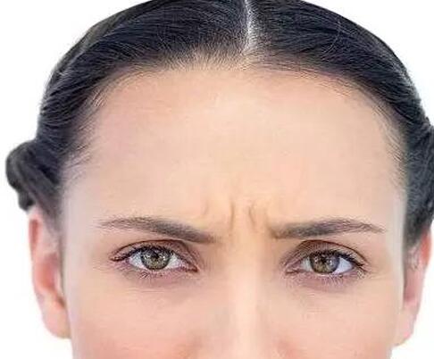 川字紋可以打肉毒毒素嗎，川字紋打肉毒毒素有沒有副作用?