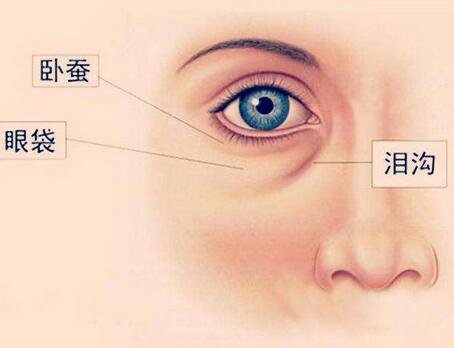 嗨體可以用來填充淚溝嗎