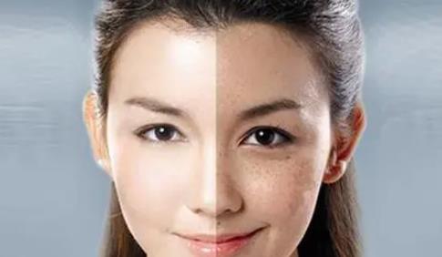 什么是鐳射凈膚?作用是什么