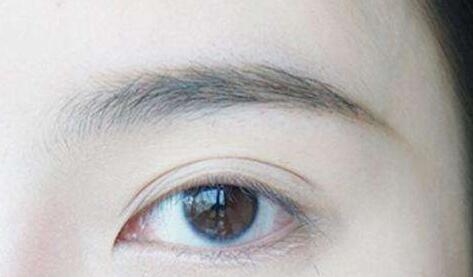 切眉手術前準備，切眉能持續(xù)多長時間?
