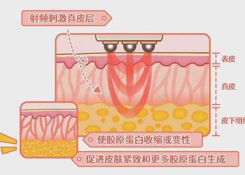 熱瑪吉畫(huà)網(wǎng)格的原因?