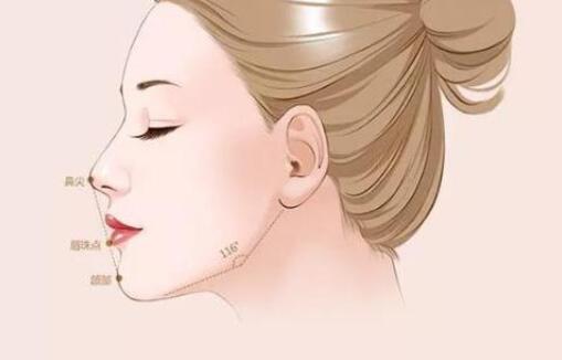 假體下巴能管多久?