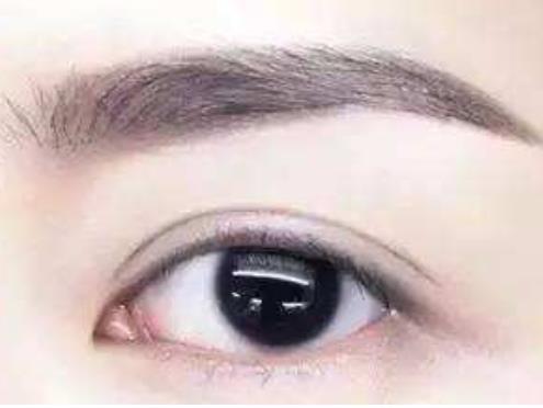 什么樣的激光儀器洗眉不出血