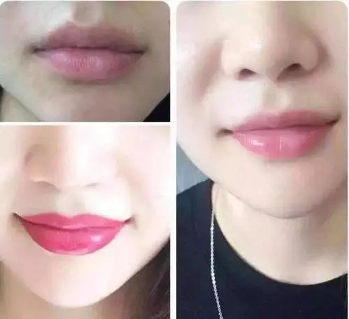 漂唇的價格是多少?