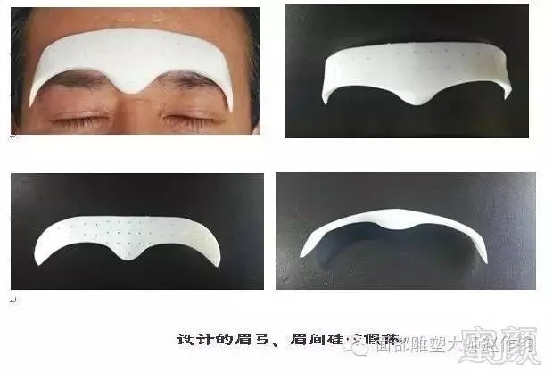 隆眉弓的果有哪些?眉弓隆高的常用方法有哪些?