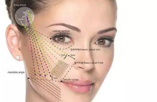 較好的去皺方法是什么?