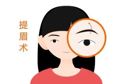 切眉手術(shù)后的疤痕怎么辦