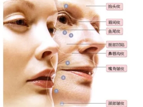 睡覺長皺紋是怎么回事?睡覺壓出皺紋應(yīng)該怎么辦?