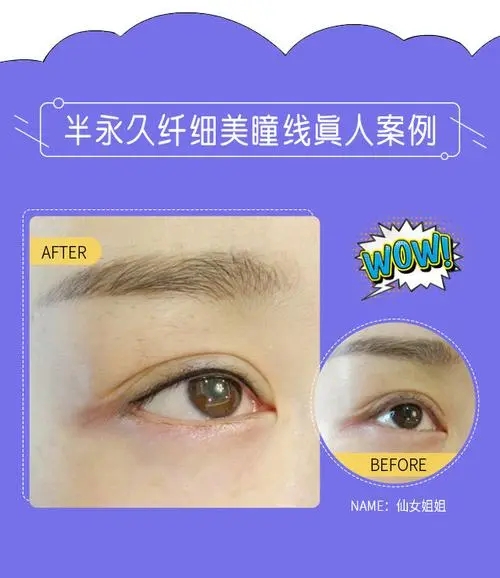 紋了美瞳線還可以化妝嗎?紋美瞳線多長時間能化妝？