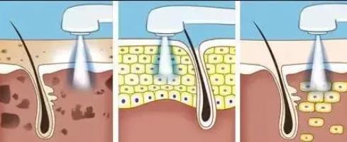 白瓷娃娃的作用是什么，有哪些美白飲食秘方