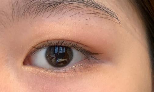 割雙眼皮要多少錢?雙眼皮割價格受哪些因素影響?